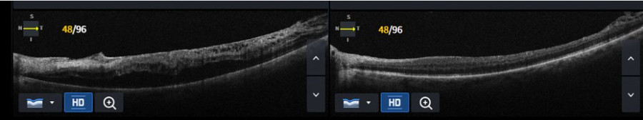 Slider image (8) Dr Nikolaos I Dervenis Eye Clinic